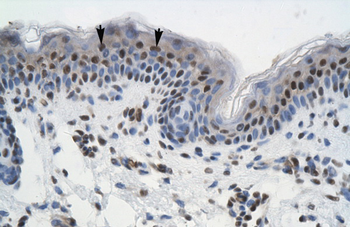 GTF2I Rabbit Polyclonal Antibody
