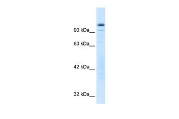 GTF2I Rabbit Polyclonal Antibody