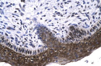 RAX Rabbit Polyclonal Antibody