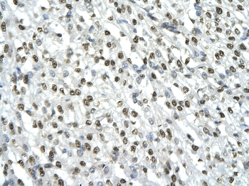 HMGB2 Rabbit Polyclonal Antibody