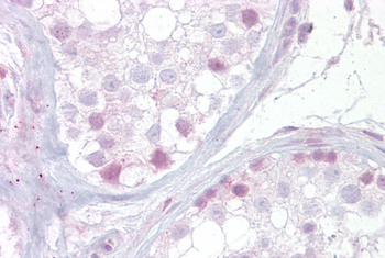 NR4A1 Rabbit Polyclonal Antibody