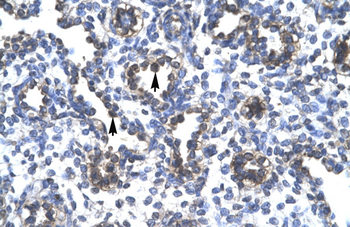 FOXA3 Rabbit Polyclonal Antibody
