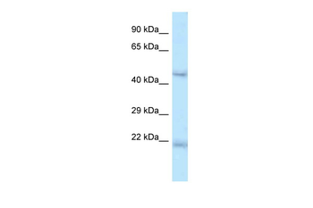 Onecut1 Rabbit Polyclonal Antibody