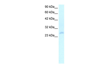 HOXC4 Rabbit Polyclonal Antibody