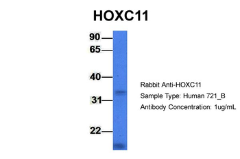 HOXC11 Rabbit Polyclonal Antibody