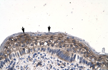 JMJD8 Rabbit Polyclonal Antibody