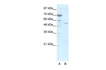 EVX2 Rabbit Polyclonal Antibody