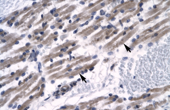 ZNF391 Rabbit Polyclonal Antibody