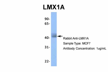 LMX1A Rabbit Polyclonal Antibody