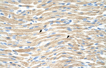 LMX1A Rabbit Polyclonal Antibody