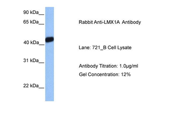 LMX1A Rabbit Polyclonal Antibody