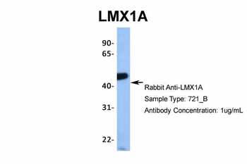 LMX1A Rabbit Polyclonal Antibody