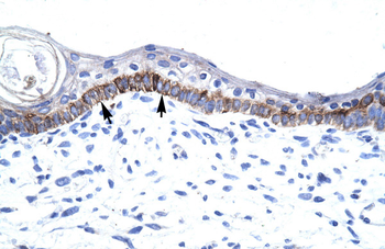 ARNTL Rabbit Polyclonal Antibody