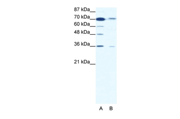 SMAD4 Rabbit Polyclonal Antibody