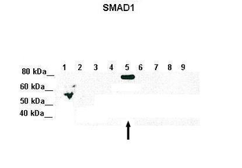 SMAD5 Rabbit Polyclonal Antibody