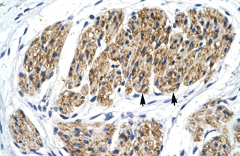 NFKB2 Rabbit Polyclonal Antibody