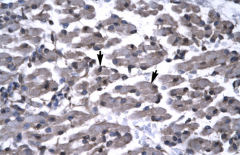 PAWR Rabbit Polyclonal Antibody