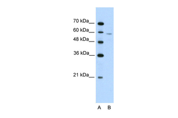 IRX4 Rabbit Polyclonal Antibody