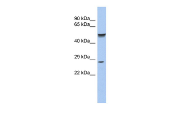 PHOX2A Rabbit Polyclonal Antibody