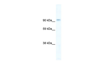 PIK3CB Rabbit Polyclonal Antibody