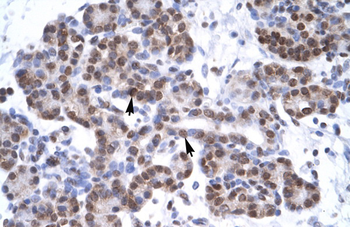 MYF6 Rabbit Polyclonal Antibody