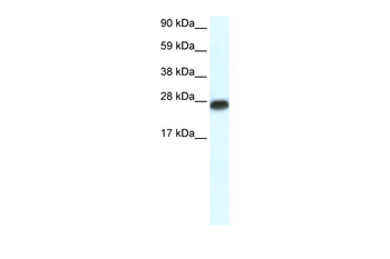 MYF6 Rabbit Polyclonal Antibody