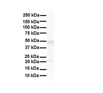 ERCC8 Rabbit Polyclonal Antibody