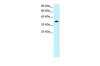 RAX Rabbit Polyclonal Antibody