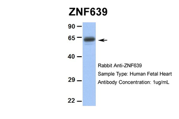 ZNF639 Rabbit Polyclonal Antibody