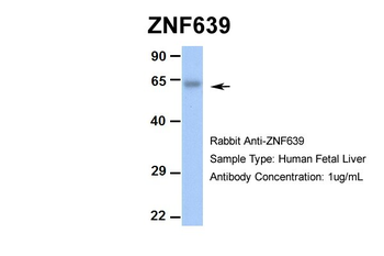 ZNF639 Rabbit Polyclonal Antibody