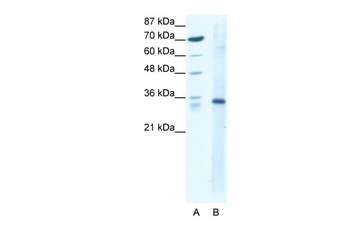 KLF3 Rabbit Polyclonal Antibody