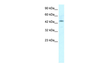 IRX2 Rabbit Polyclonal Antibody
