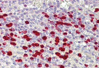ZNF746 Rabbit Polyclonal Antibody