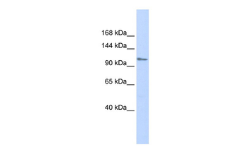 ZFPM1 Rabbit Polyclonal Antibody