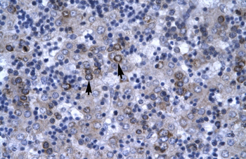 DBP Rabbit Polyclonal Antibody