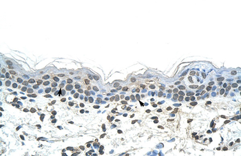 DLX2 Rabbit Polyclonal Antibody