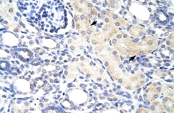 DLX3 Rabbit Polyclonal Antibody