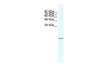 E2F6 Rabbit Polyclonal Antibody