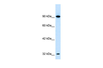 SOX30 Rabbit Polyclonal Antibody
