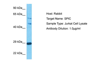 SPIC Rabbit Polyclonal Antibody