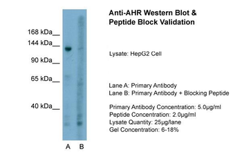 AHR Rabbit Polyclonal Antibody