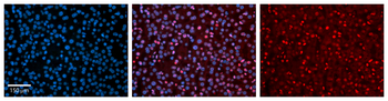 NR2F6 Rabbit Polyclonal Antibody