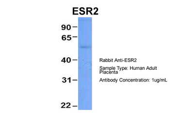 ESR2 Rabbit Polyclonal Antibody