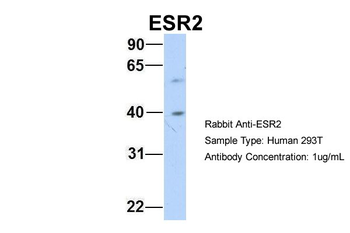 ESR2 Rabbit Polyclonal Antibody