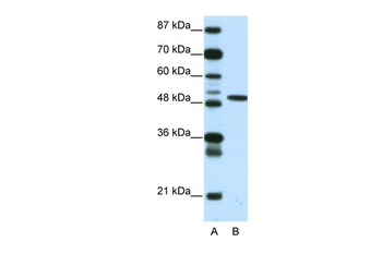 ETV5 Rabbit Polyclonal Antibody
