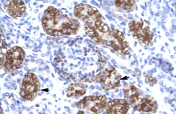 ZNF409 Rabbit Polyclonal Antibody