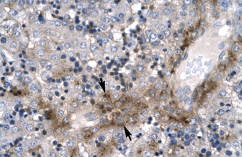 ZNF365 Rabbit Polyclonal Antibody