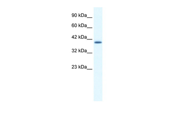 ZNF365 Rabbit Polyclonal Antibody
