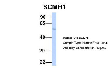 SCMH1 Rabbit Polyclonal Antibody