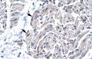 FOXE3 Rabbit Polyclonal Antibody